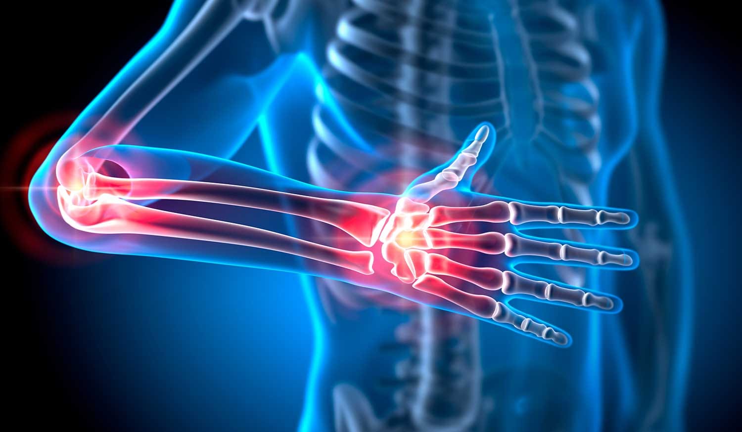 Hand Relief & Support